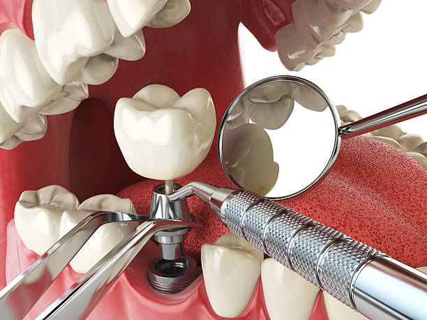 Best Emergency Gum Treatment in Fall Creek, WI